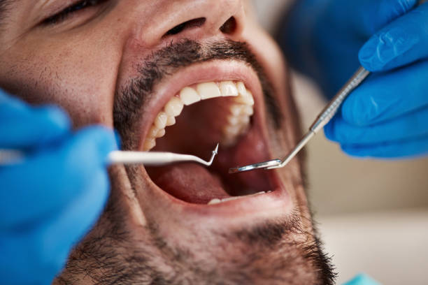 Best Emergency Treatment for Dental Infections or Abscesses in Taneytown, MD