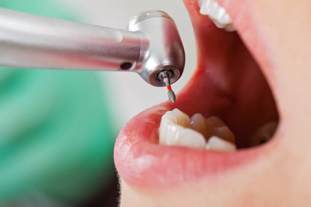 Best Cosmetic Emergency Dentistry in Taneytown, MD
